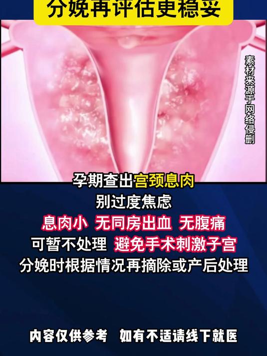 孕期查出宫颈息肉?无症状别焦虑,分娩再评估更稳妥