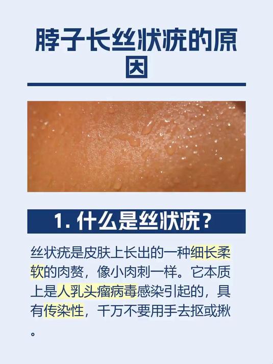 脖子长丝状疣的原因