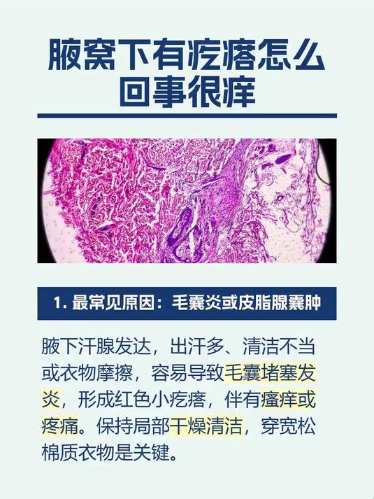 腋窝下有疙瘩怎么回事很痒