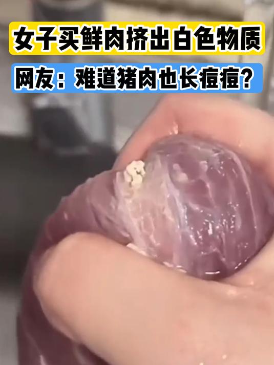 难道猪肉也长痘?女子买鲜肉挤出白色物质