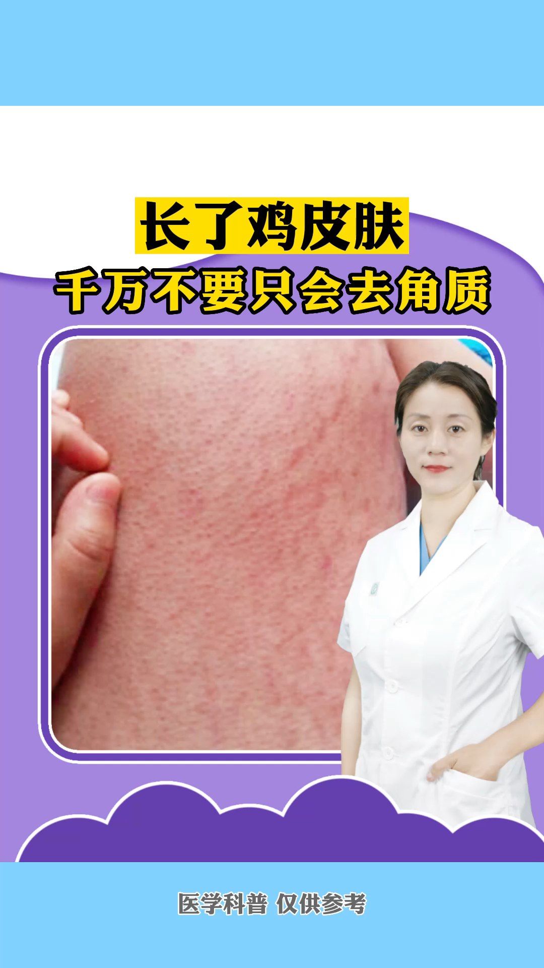 长了鸡皮肤千万不要只会去角质