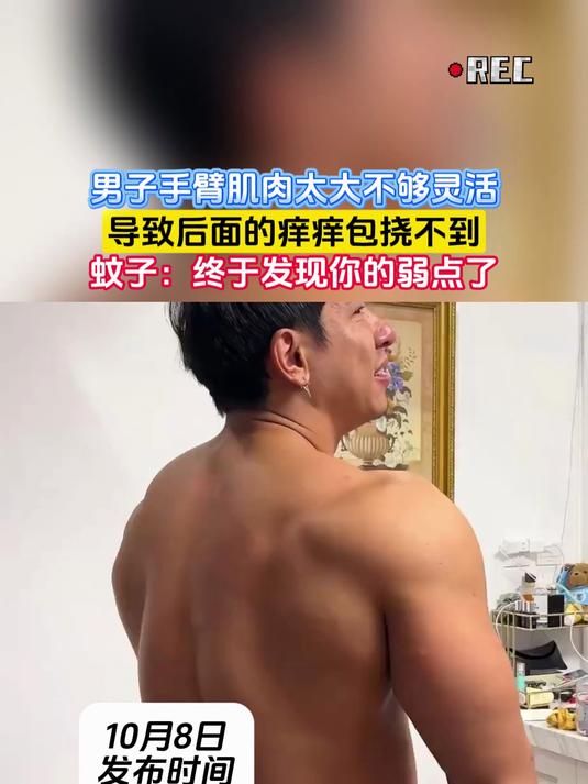 男子手臂肌肉太大不够灵活,导致后面的痒痒包挠不到