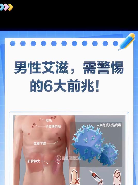 男人艾滋6个前兆，你知道吗？