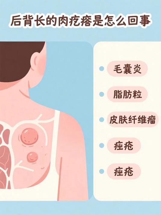 后背长的肉疙瘩是怎么回事 #健康扬帆季#