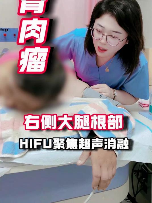 骨肉瘤右侧大腿根部HIFU聚焦超声消融