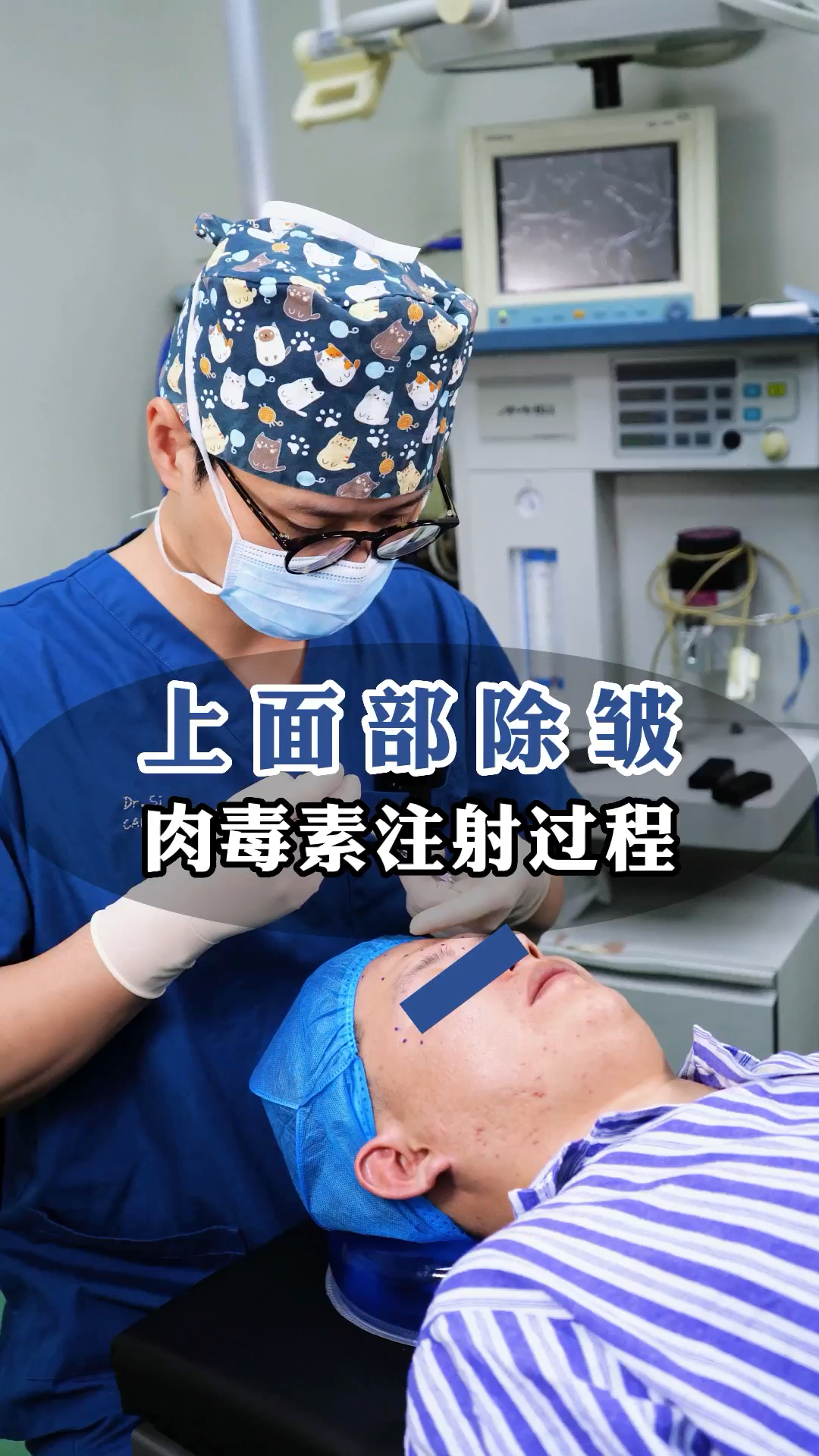 上面部除皱的肉毒素注射全过程#医美#