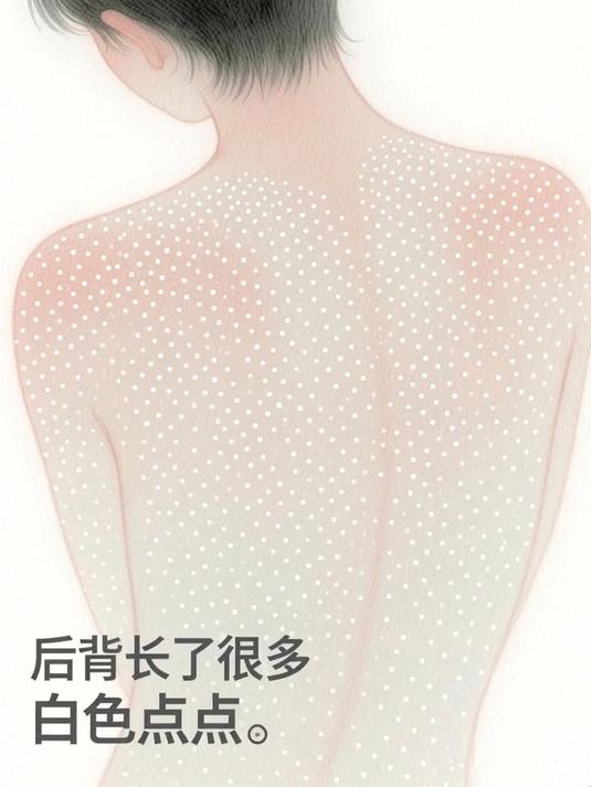 后背长了很多白色点点