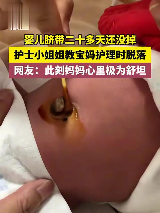 婴儿脐带二十多天还没掉,护士小姐姐教宝妈护理时脱落