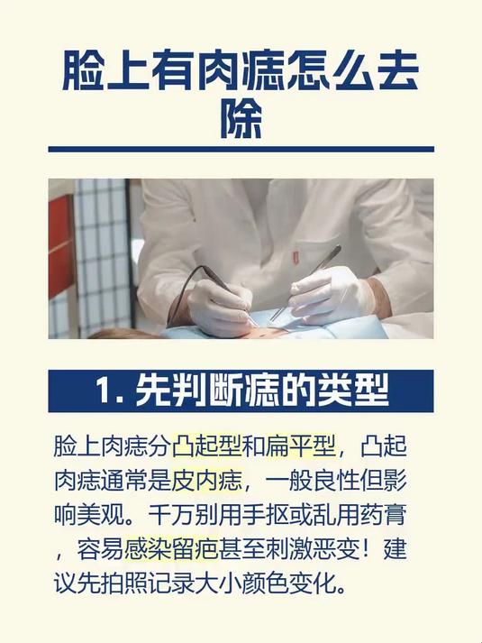 脸上有肉痣怎么去除