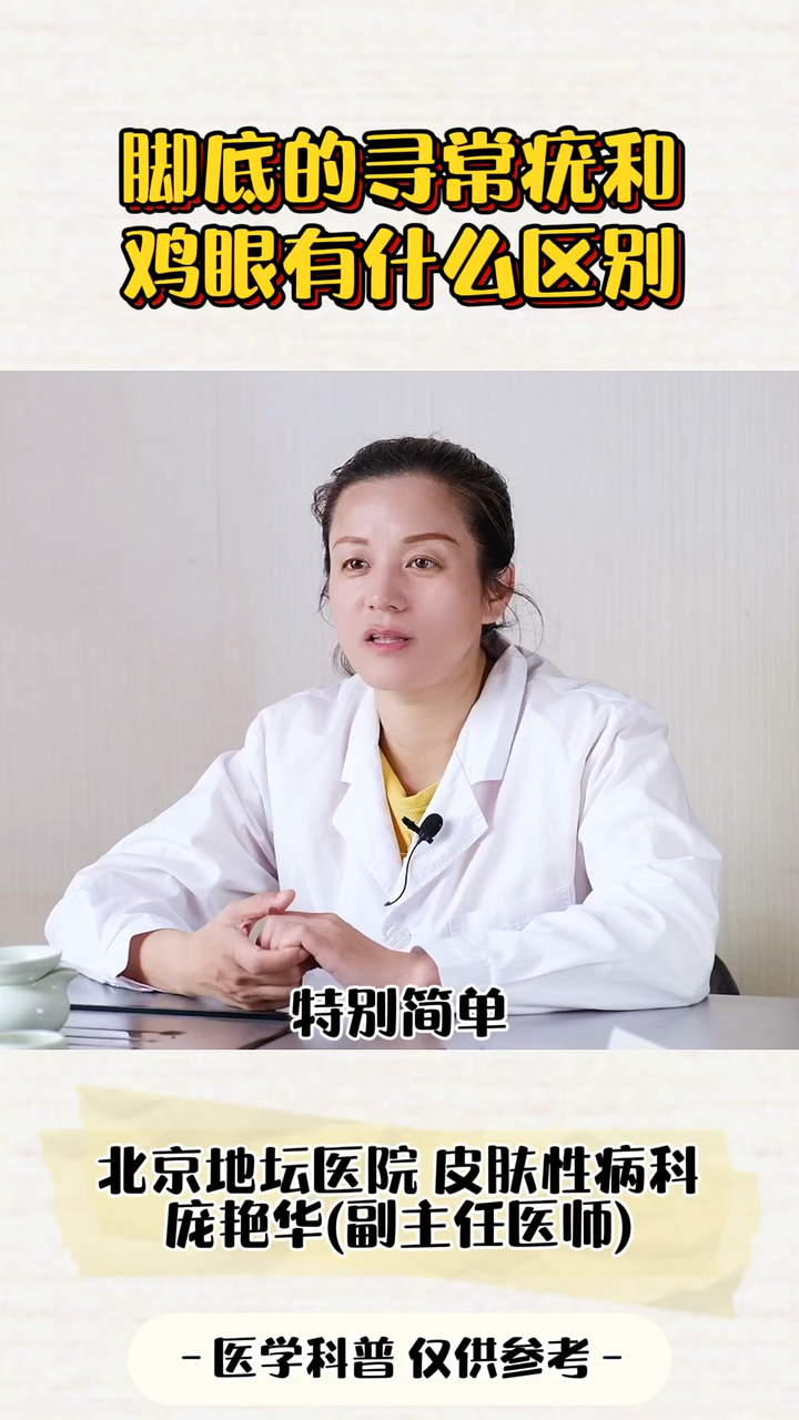 脚底的寻常疣和鸡眼有什么区别