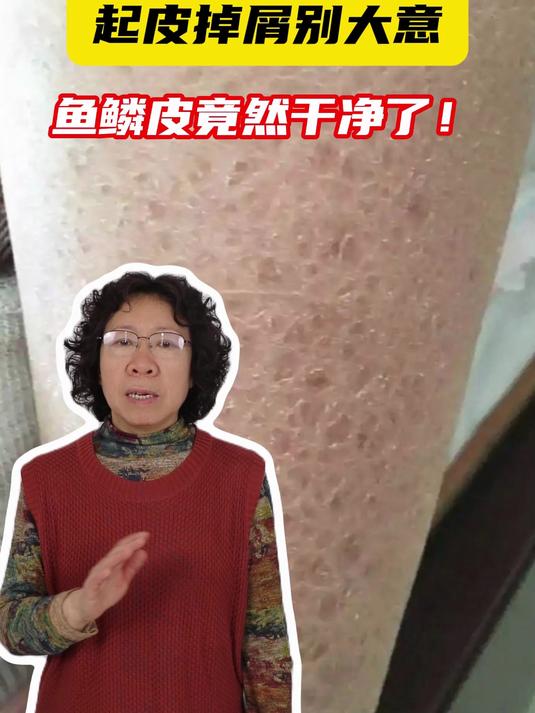 起皮掉屑别大意 鱼鳞皮竟然干净了!