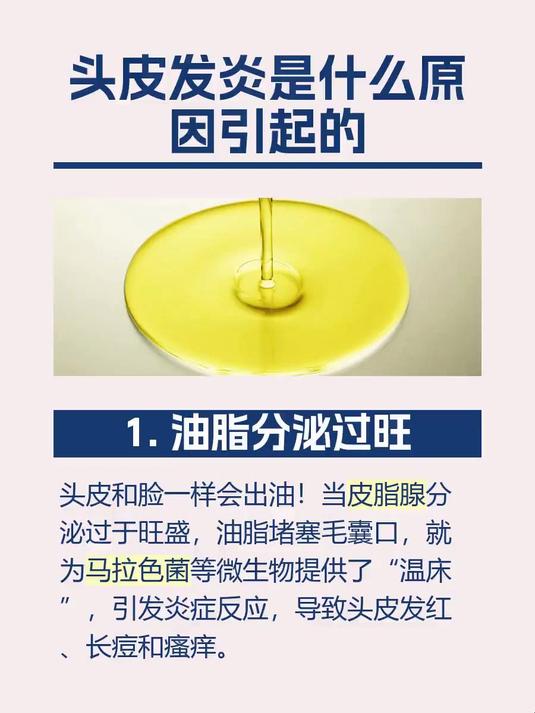 头皮发炎是什么原因引起的