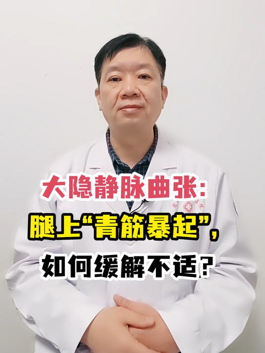 大隐静脉曲张:腿上“青筋暴起”,如何缓解不适?