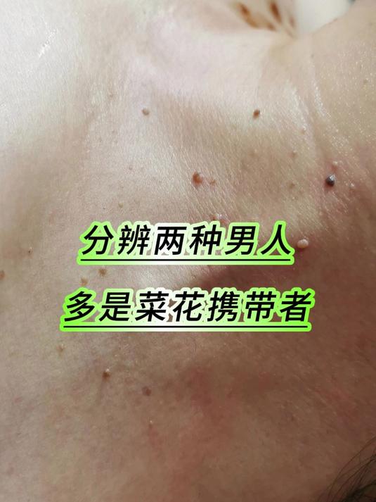 分辨两种男人，多是菜花携带者