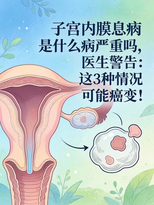 子宫内膜息肉是什么病严重吗,医生警告:这3种情况可能癌变!