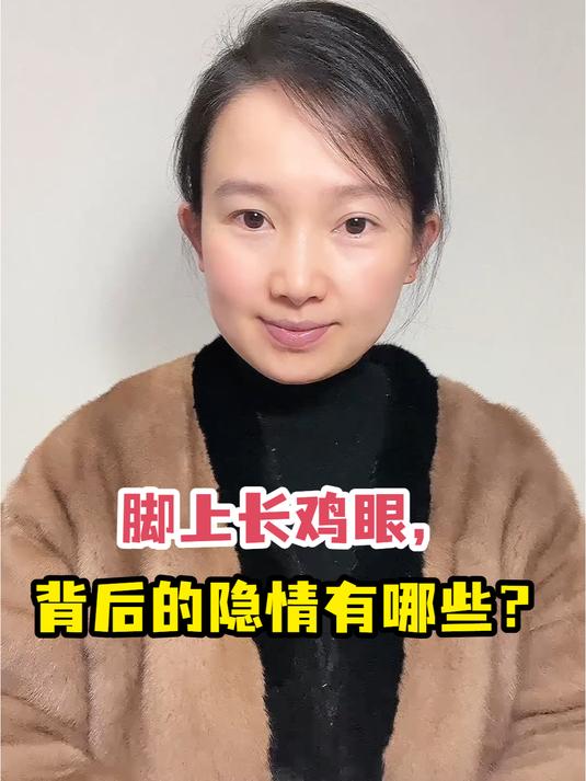 脚上长鸡眼,背后的隐情有哪些?