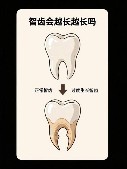 智齿会越长越长吗 #健康扬帆季#
