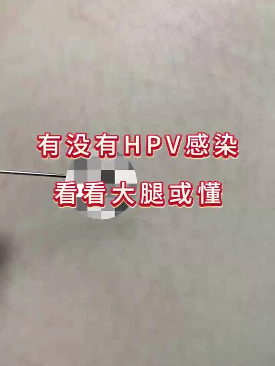 有没有HPV感染,看看大腿或懂