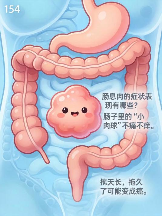 肠息肉的症状表现有哪些，肠子里的“小肉球”不痛不痒，拖久了可能变成癌