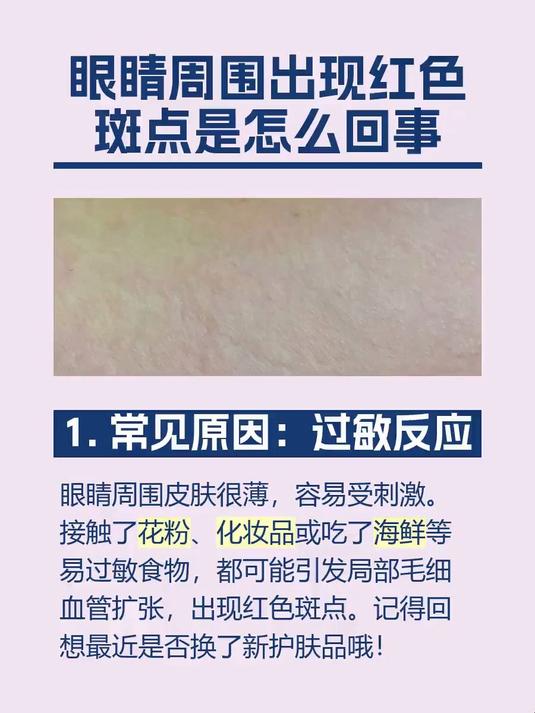 眼睛周围出现红色斑点是怎么回事