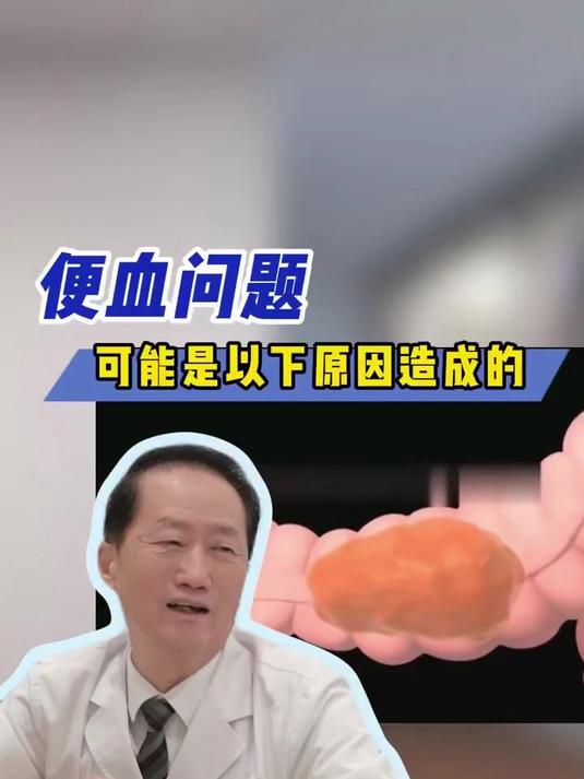大便带血,可能是以下几种原因!