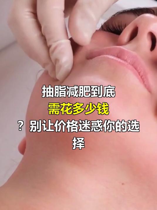 抽脂减肥要多少钱