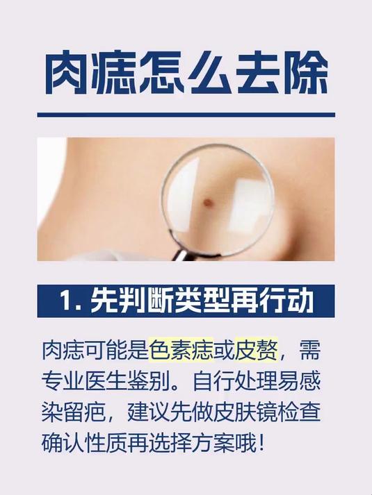 肉痣怎么去除
