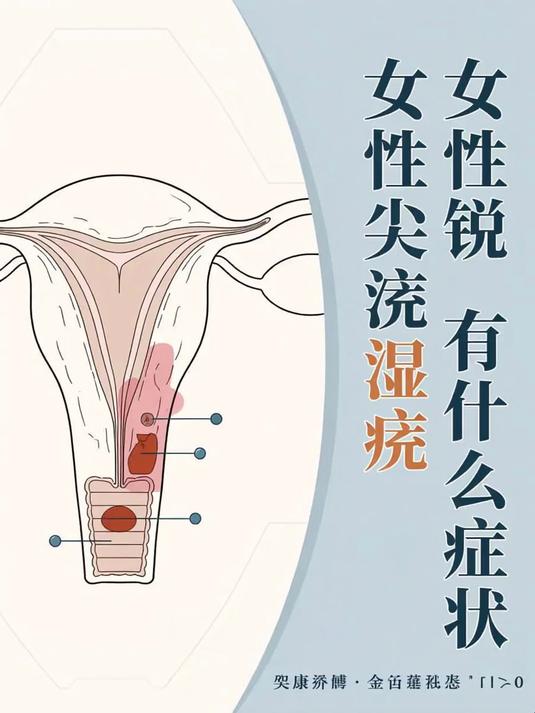 女性湿锐疣尖有什么症状