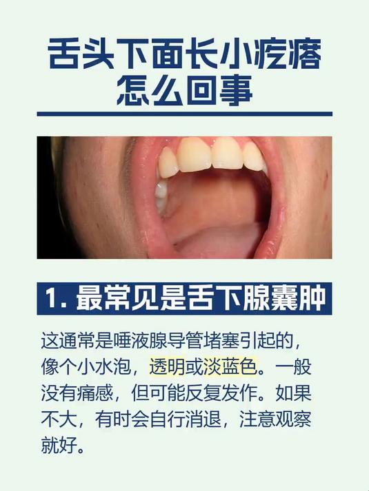 舌头下面长小疙瘩怎么回事