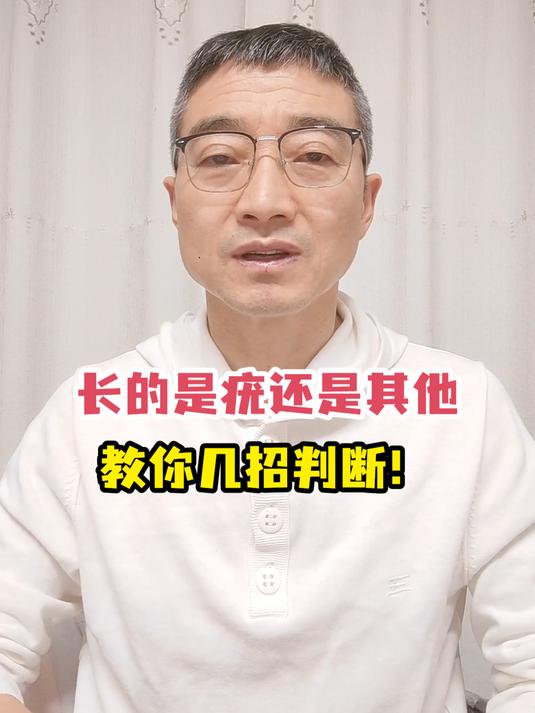 长的是疣还是其他教你几招判断!