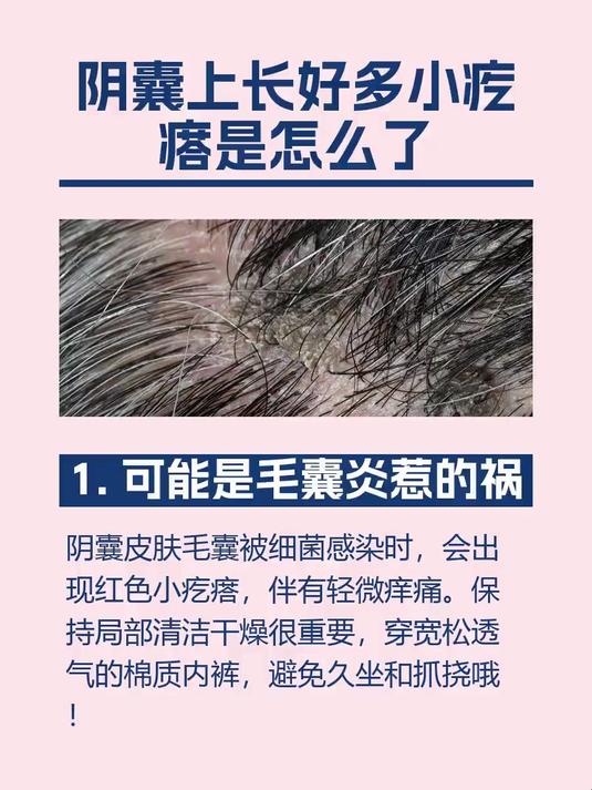 阴囊上长好多小疙瘩是怎么了