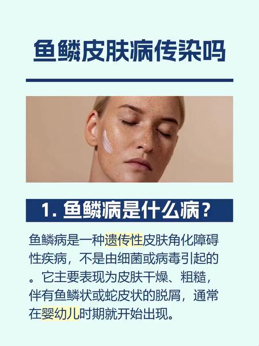 #马上健康过大年#鱼鳞皮肤病传染吗