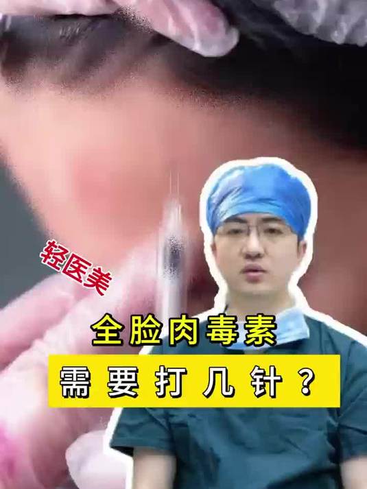 全脸肉毒素需要打几针?
