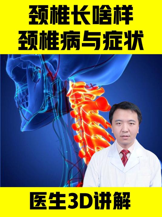 颈椎病发生在颈椎,颈椎解剖及颈椎病症状,医生用3D视频讲解