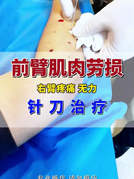 前臂肌肉劳损，右臂疼痛，无力