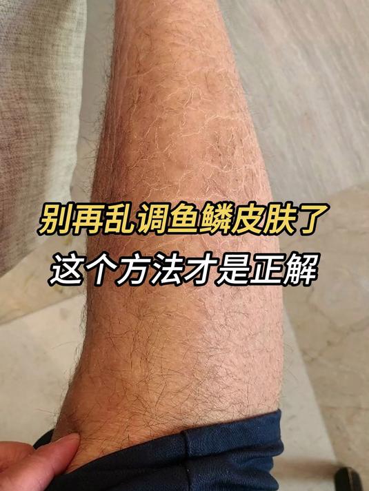 别再乱调鱼鳞皮肤了!这个方法才是正解