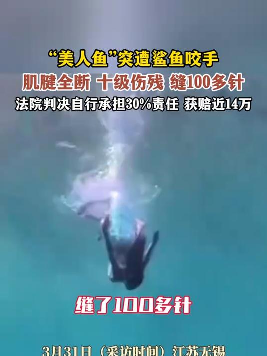 “美人鱼”突遭鲨鱼咬手!肌腱全断、十级伤残、缝100多针