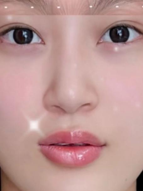 肉毒素全脸提升效果怎样?美莲张敬花案例:一针解锁上扬密码!