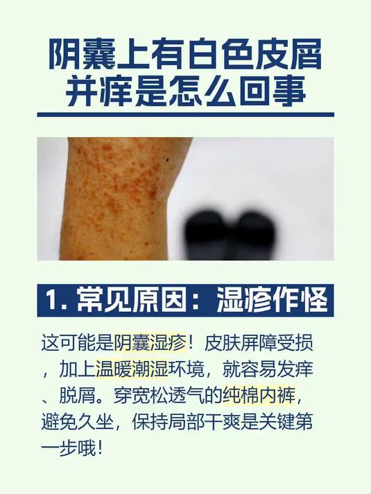 阴囊上有白色皮屑并痒是怎么回事