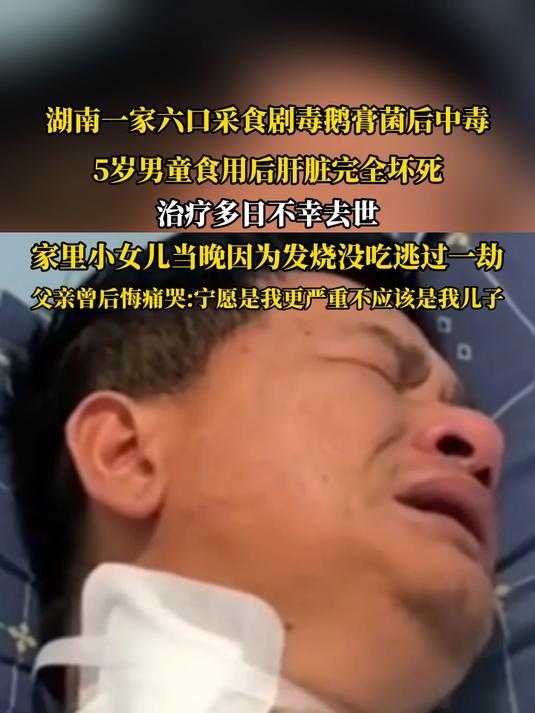 湖南一家六口采食剧毒鹅膏菌后中毒,5岁男童食用后肝脏完全坏死