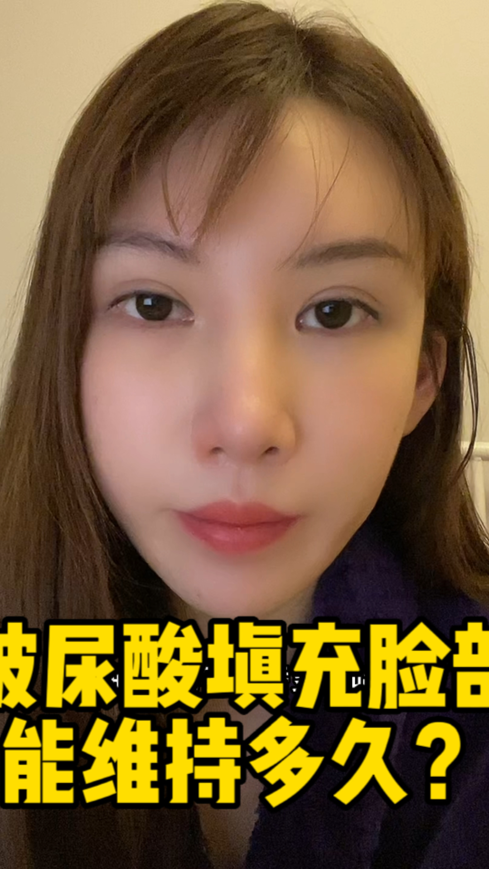 玻尿酸填充脸部可以维持多久?