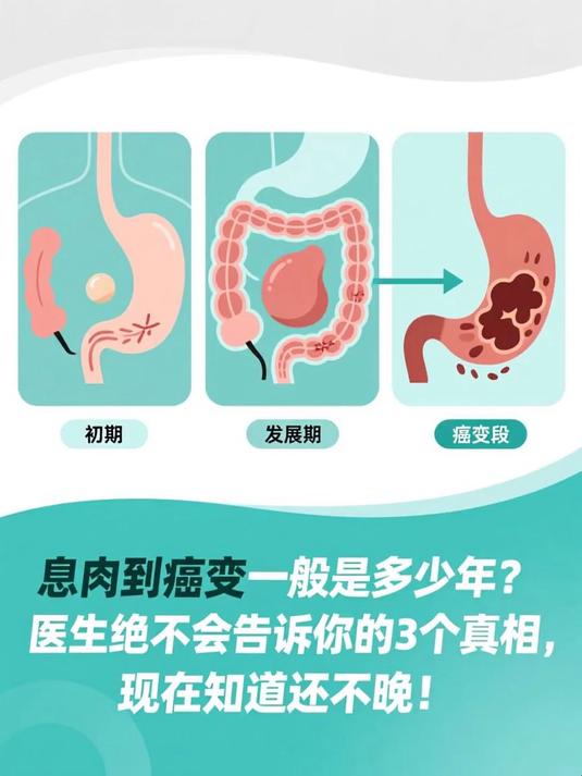 息肉到癌变一般是多少年？医生绝不会告诉你的3个真相，现在知道还不晚！#健康扬帆季#