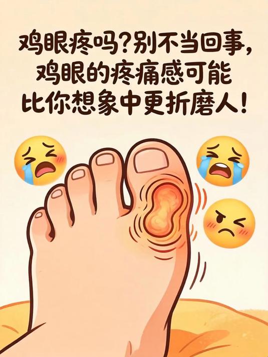鸡眼疼吗？别不当回事，鸡眼的疼痛感可能比你想象中更折磨人！