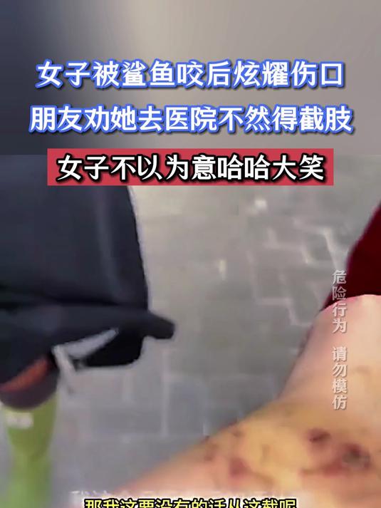 女子被鲨鱼咬后炫耀伤口,朋友劝她去医院不然得截肢
