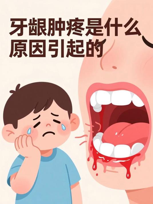 牙龈肿疼是什么原因引起的 #健康扬帆季#