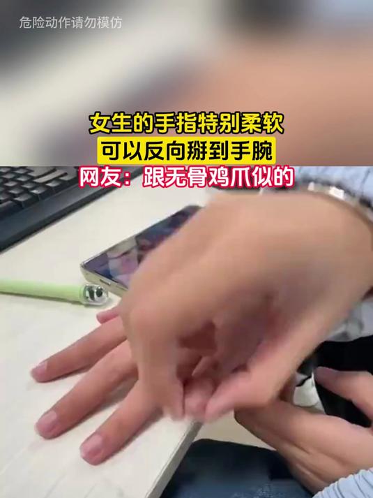女生的手指特别柔软,可以反向掰到手腕,网友:跟无骨鸡爪似的