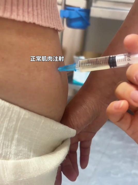 护士打针日常，正常肌肉注射臀部打针#护士打针日常#