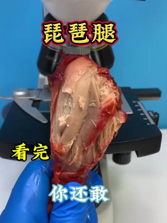 琵琶腿肉和鸡腿有区别吗?