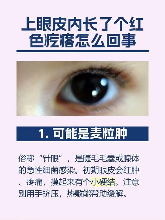 上眼皮内长了个红色疙瘩怎么回事