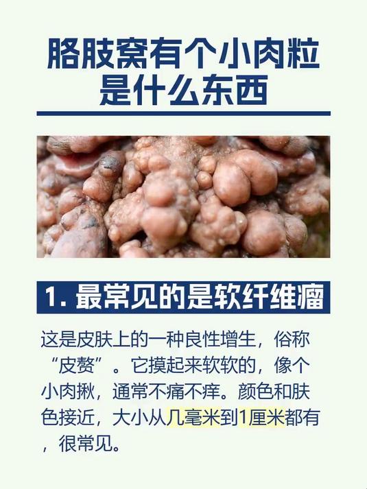 胳肢窝有个小肉粒是什么东西